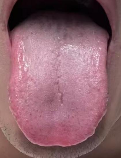体质亏虚、精神不济、身心乏力？中医填精温阳疏肝，温和固本调理







很多