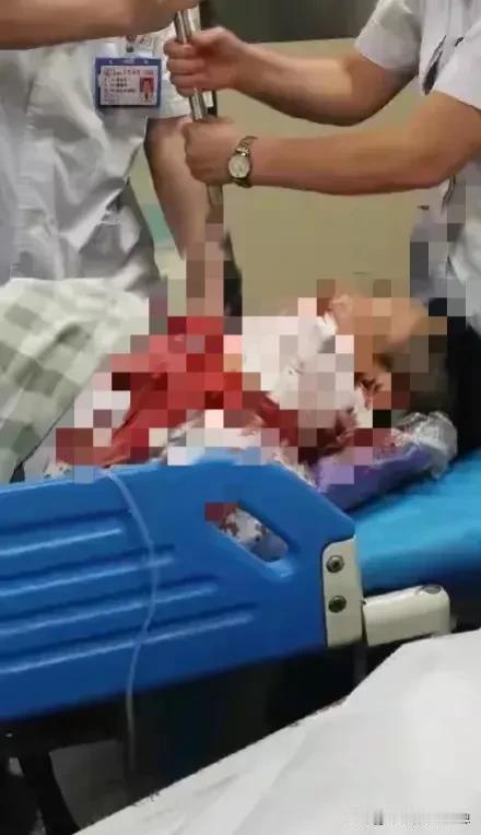 好吓人，居然砍错了人？7月19号下午，温州医科大学附属第一医院，一名著名的心内科