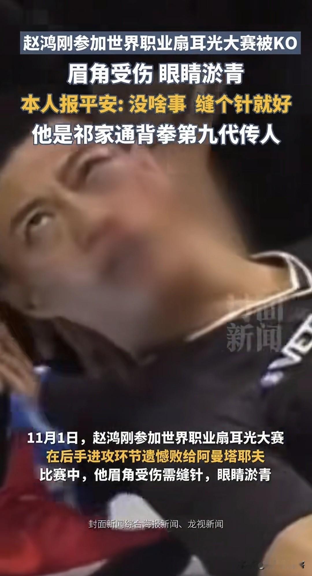 通臂拳第九代传人参加世界职业扇耳光大赛居然受伤了，不过据他本人回应无大碍。202