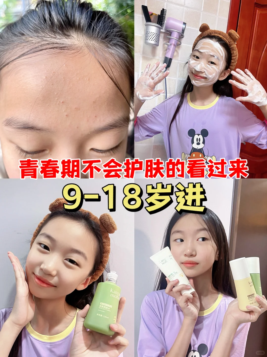 初中生看过来 青春期女孩必入的护肤三件套