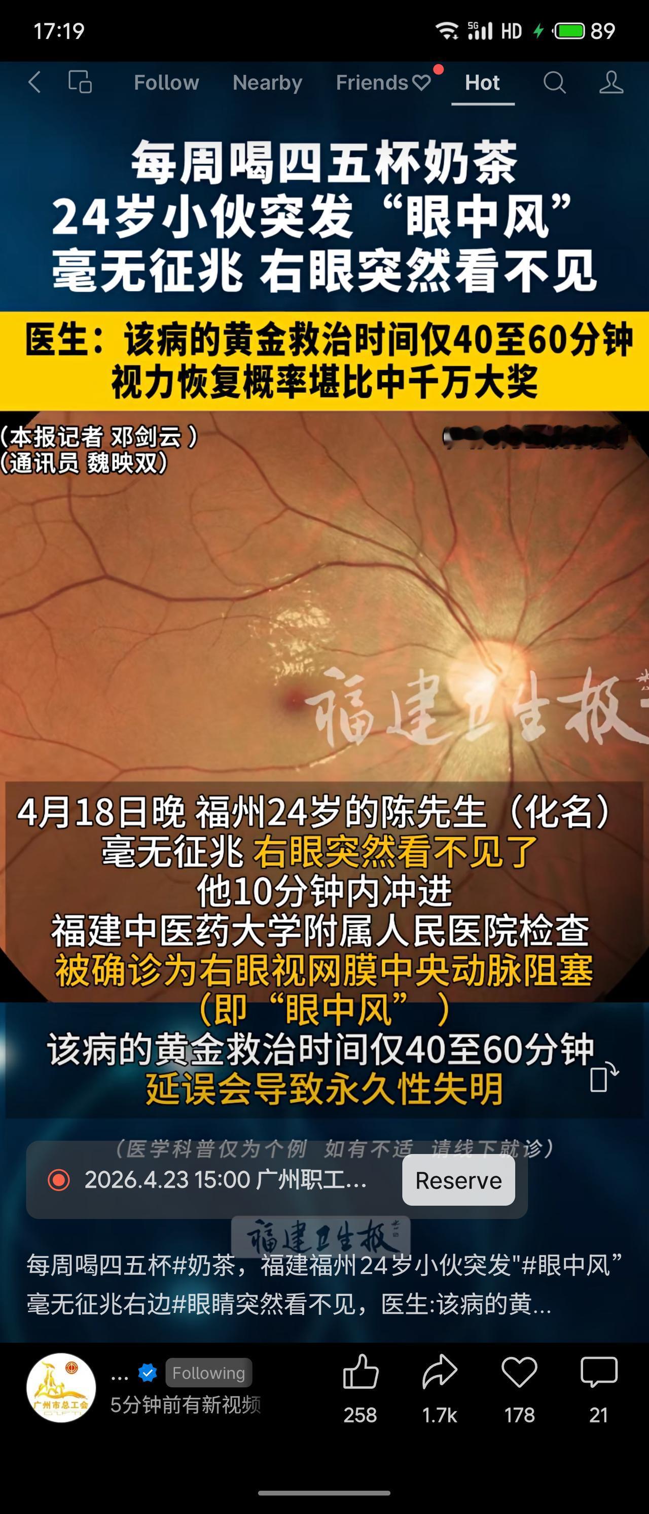 福建福州24岁小伙每周喝4-5杯奶茶，突发右眼“眼中风”（视网膜中央动脉阻塞），