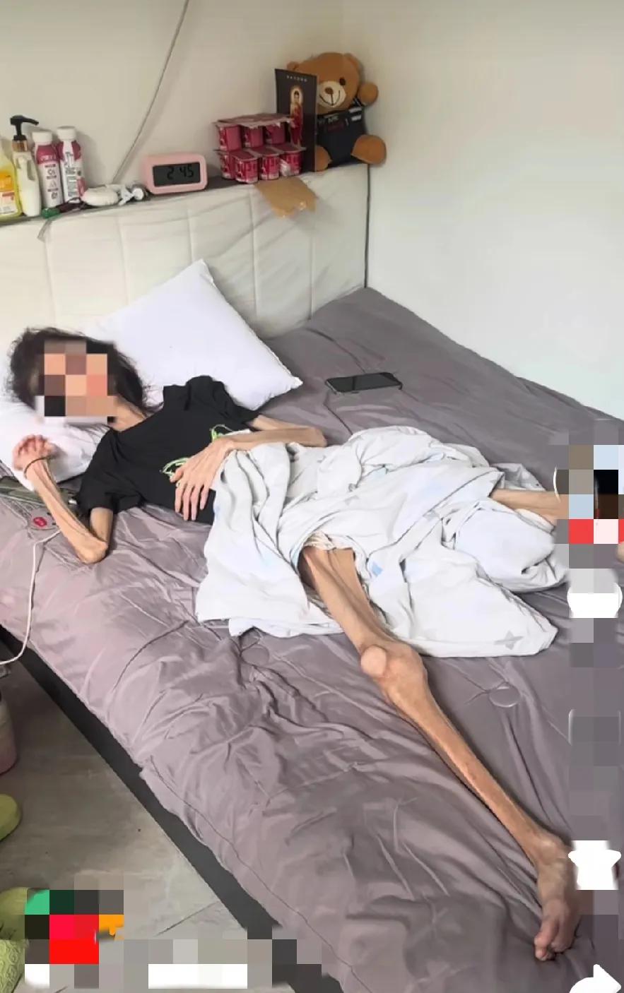 女生不要减肥太过了，容易得厌食症，想再胖都难，瘦成了这样子，毫无美感。
对身体都