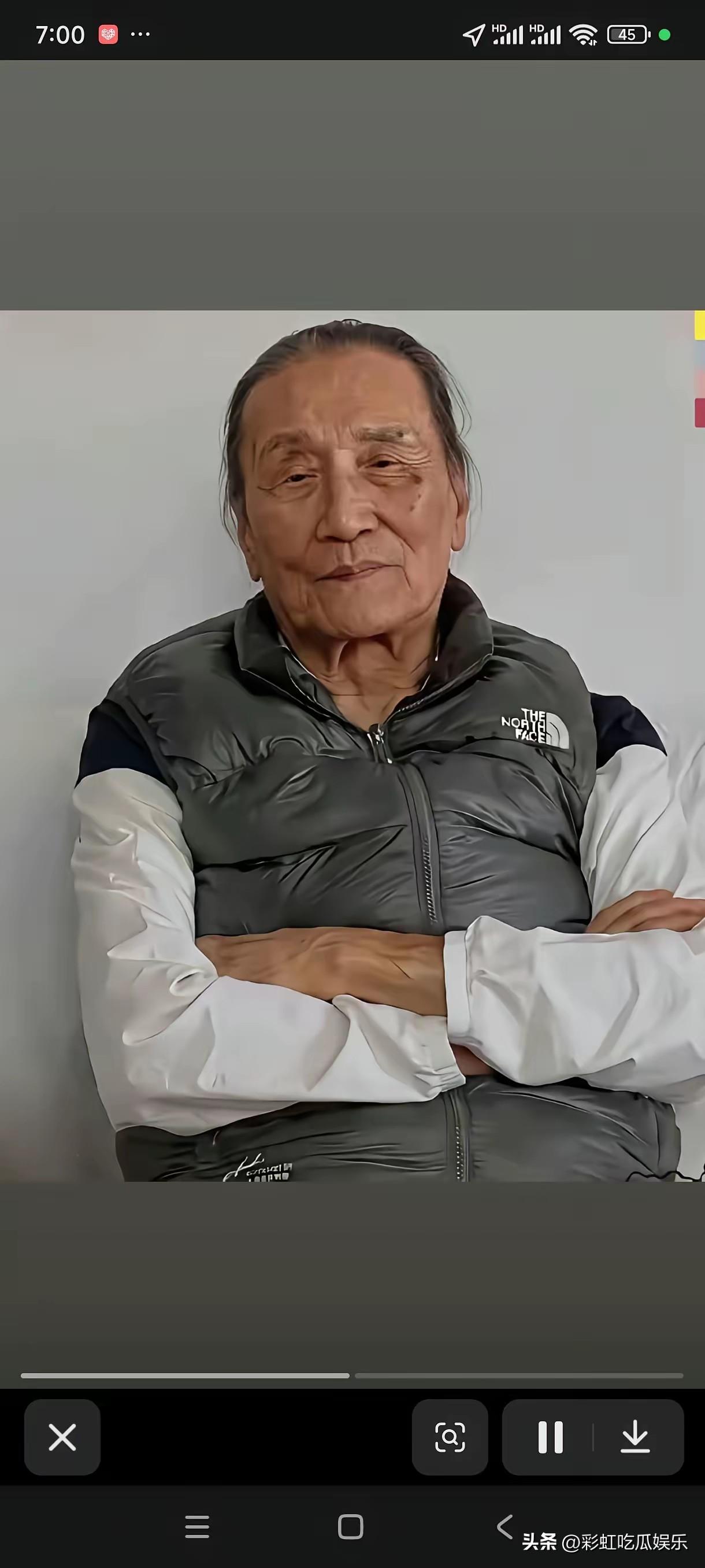 这是谢贤生前最后一张照片，脸色蜡黄眼睛都快睁不开了，皮下脂肪几乎没有，只剩皮包骨