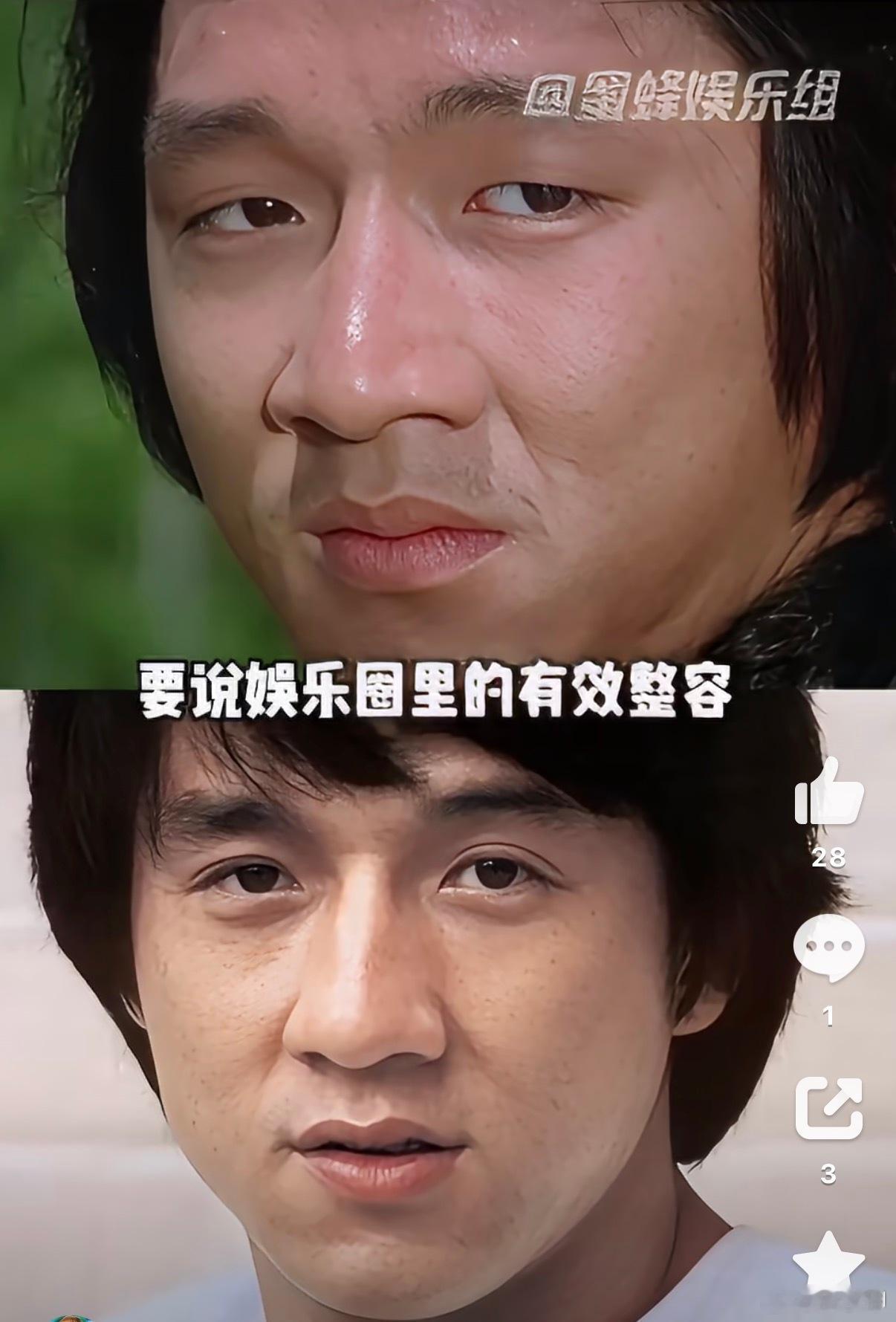 成龙的双眼皮是整容的经典案例，现在AI这么强悍，整之前先看下效果图。相由心生20