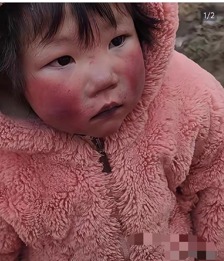 谁能想象，一个4岁孩子的童年，是在缺氧中熬过来的？

河南小女孩佳佳，一出生就带