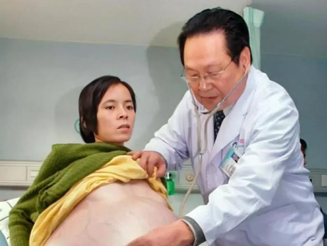 12年过去，当年轰动一时的广东“巨腹女人”彭细妹，后来怎样了？
 
在2009年