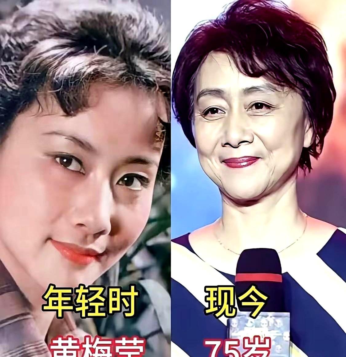 李嘉欣生图曝光，这次彻底崩了。
 
曾被港媒评为“最美港姐”，如今面部凹陷，眼纹