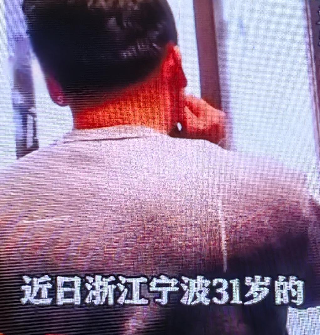 31岁不抽烟的她，陪母体检竟查出肺癌！医生：这两大日常“隐形杀手”很多女性都忽略