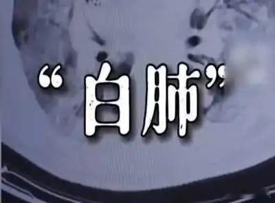 白肺，应该如何正确治疗？白肺，一般是指重症肺炎患者在X光或CT检查下的显现；指，