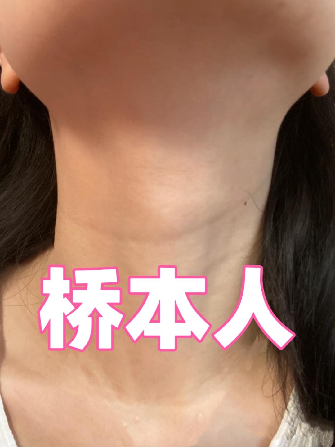 不删！备孕前的姐妹一定要去做甲功七项！