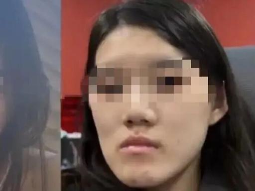 还不如之前！24 岁姑娘开开心心躺上手术台，就想做个小微调改善脸上一丁点不起眼的