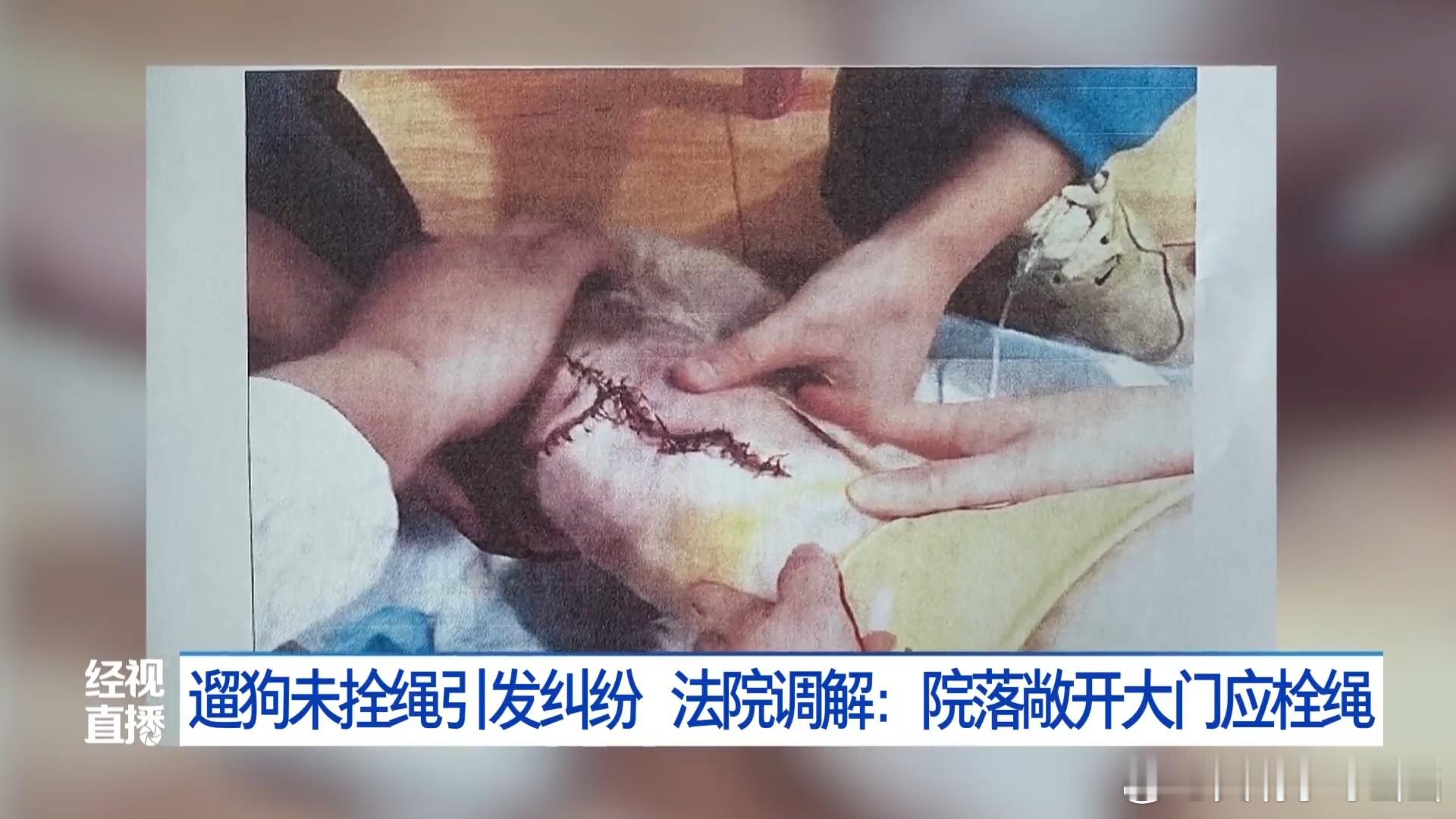 就这么个狗咬狗的事儿，都要删掉。祖宗严选中华田园犬的英勇事迹，力拔铁门气盖世的养
