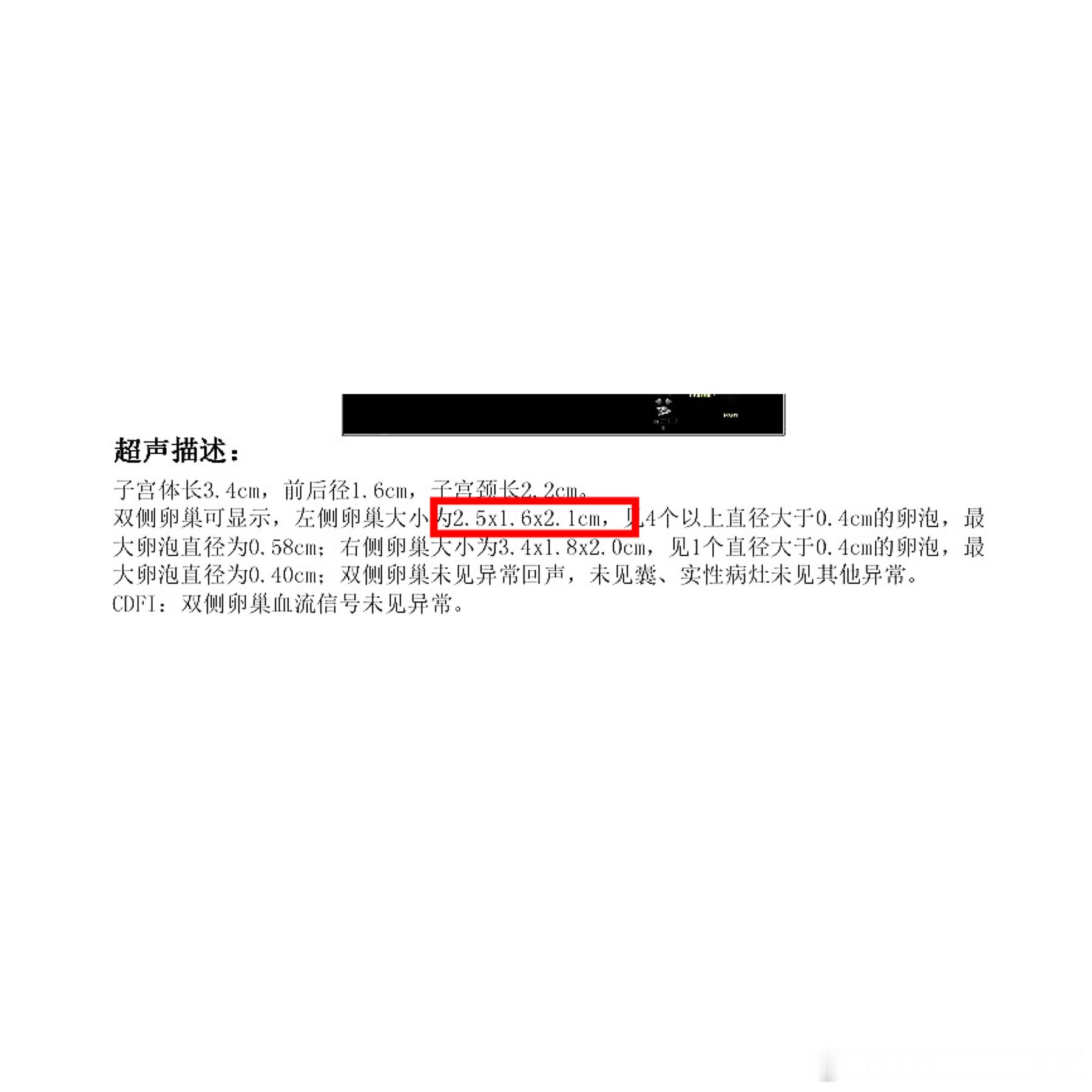 来一道数学题[嘻嘻]在性早熟或早发育的评估中，卵巢容积的大小是其中一项参考依据。