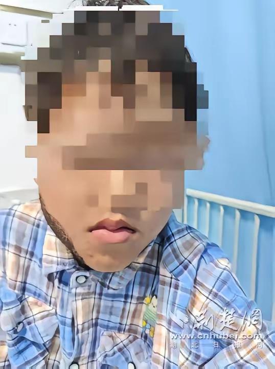 生死竞速11天！8岁男童江边戏水遇剧毒蛇吻，医生逆天闯关救命
 
夏天江边浅滩成