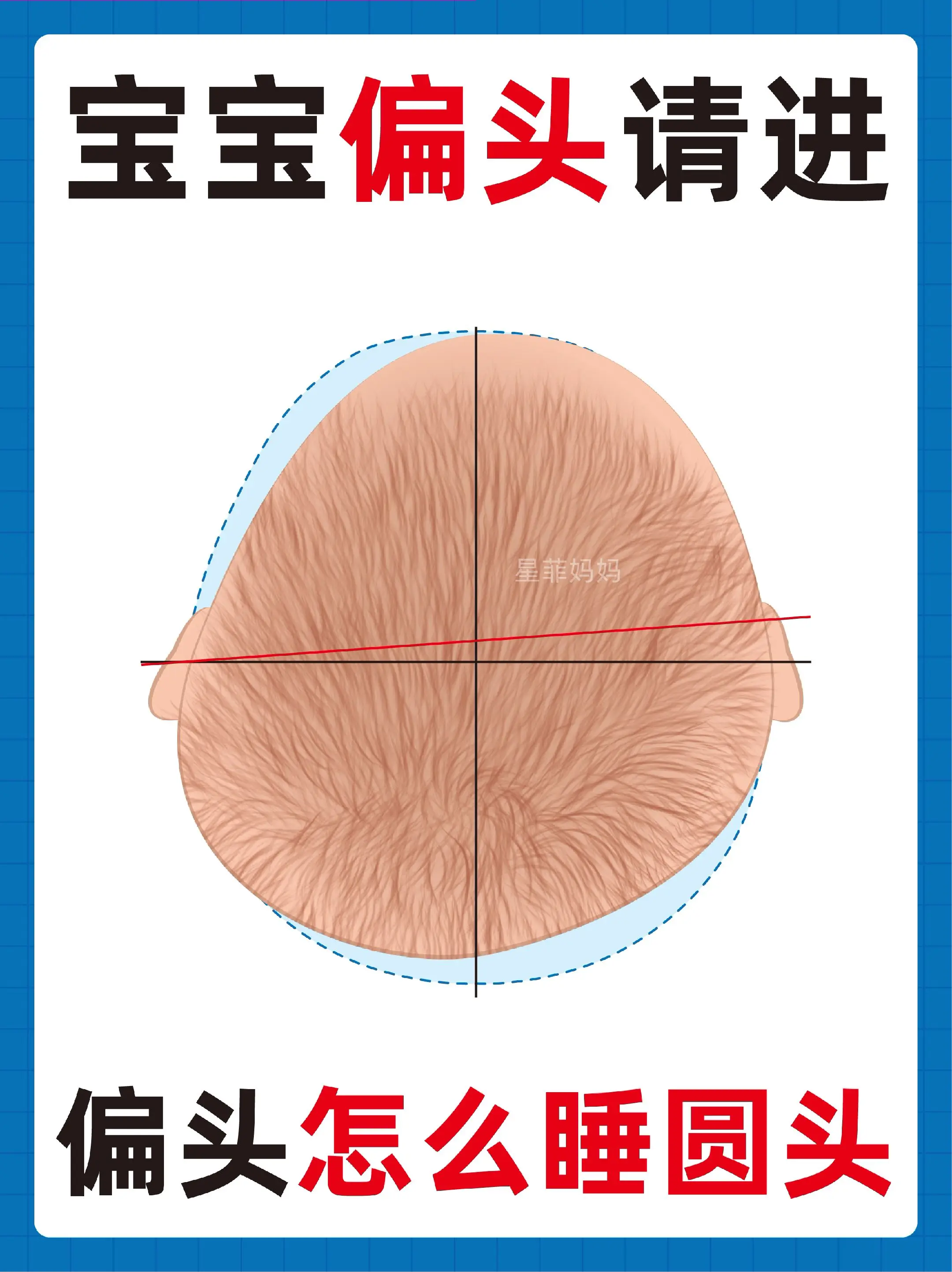 宝宝头型|全类的偏头如何睡圆头。