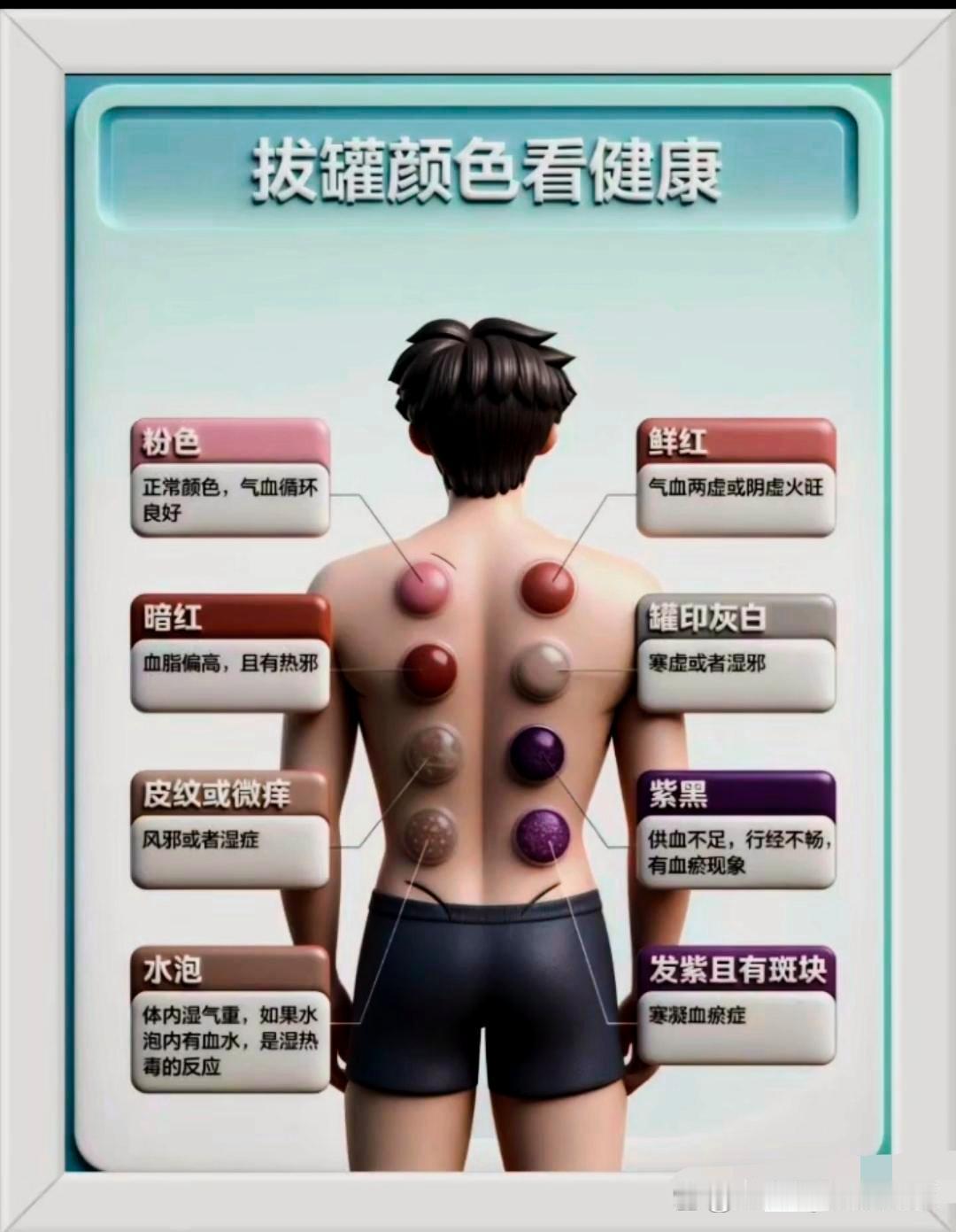 拔罐看着就疼啊