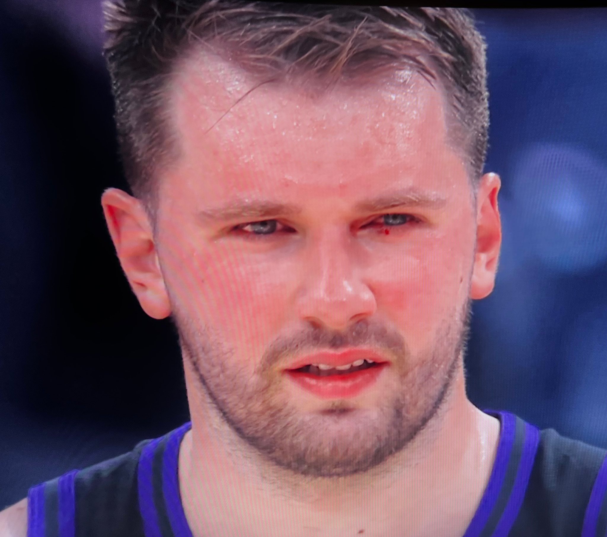 第一节，湖人33-25魔术，东契奇11分4板4助攻。 