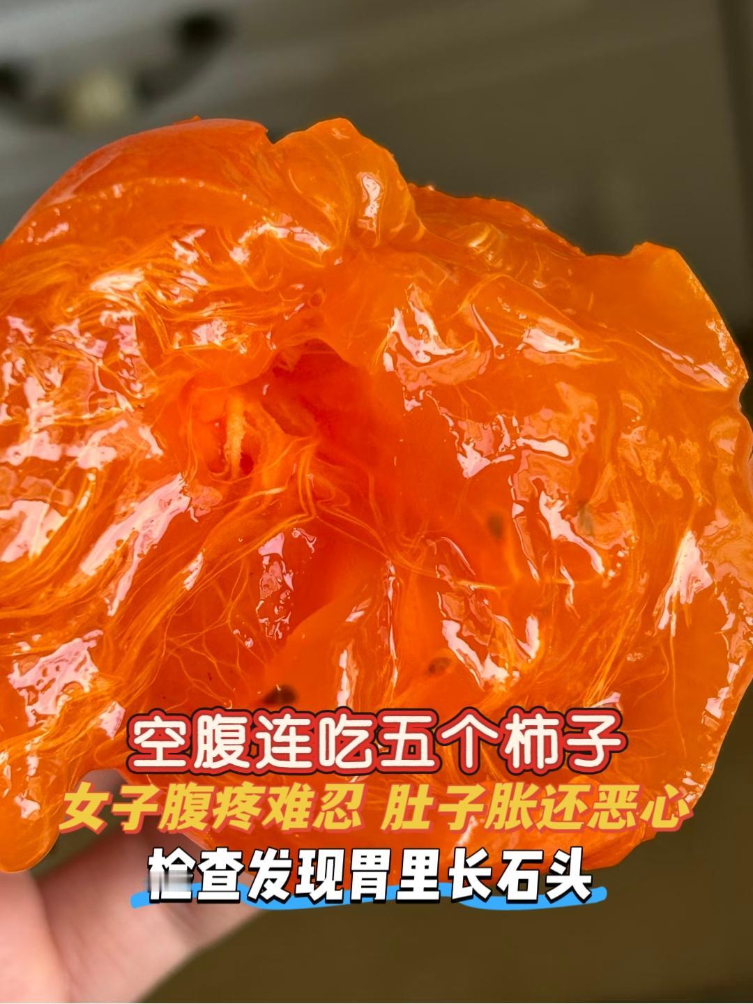 悲剧还是发生了！湖南张阿姨空腹一口气炫5个熟透的柿子，没一会儿就胃疼到直不起腰，