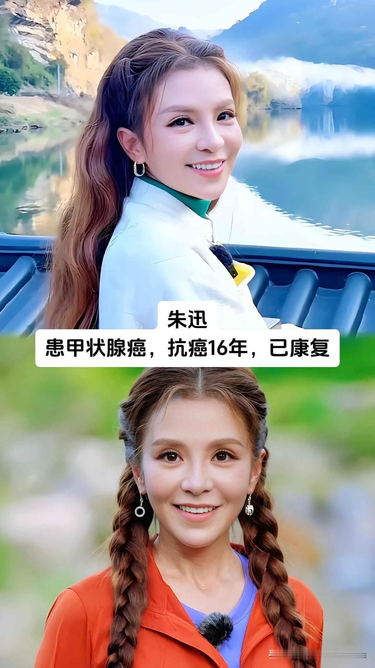 谁能想到多次站上央视春晚舞台的朱迅，早已和甲状腺癌抗争16年并成功康复，蔡琴、吴