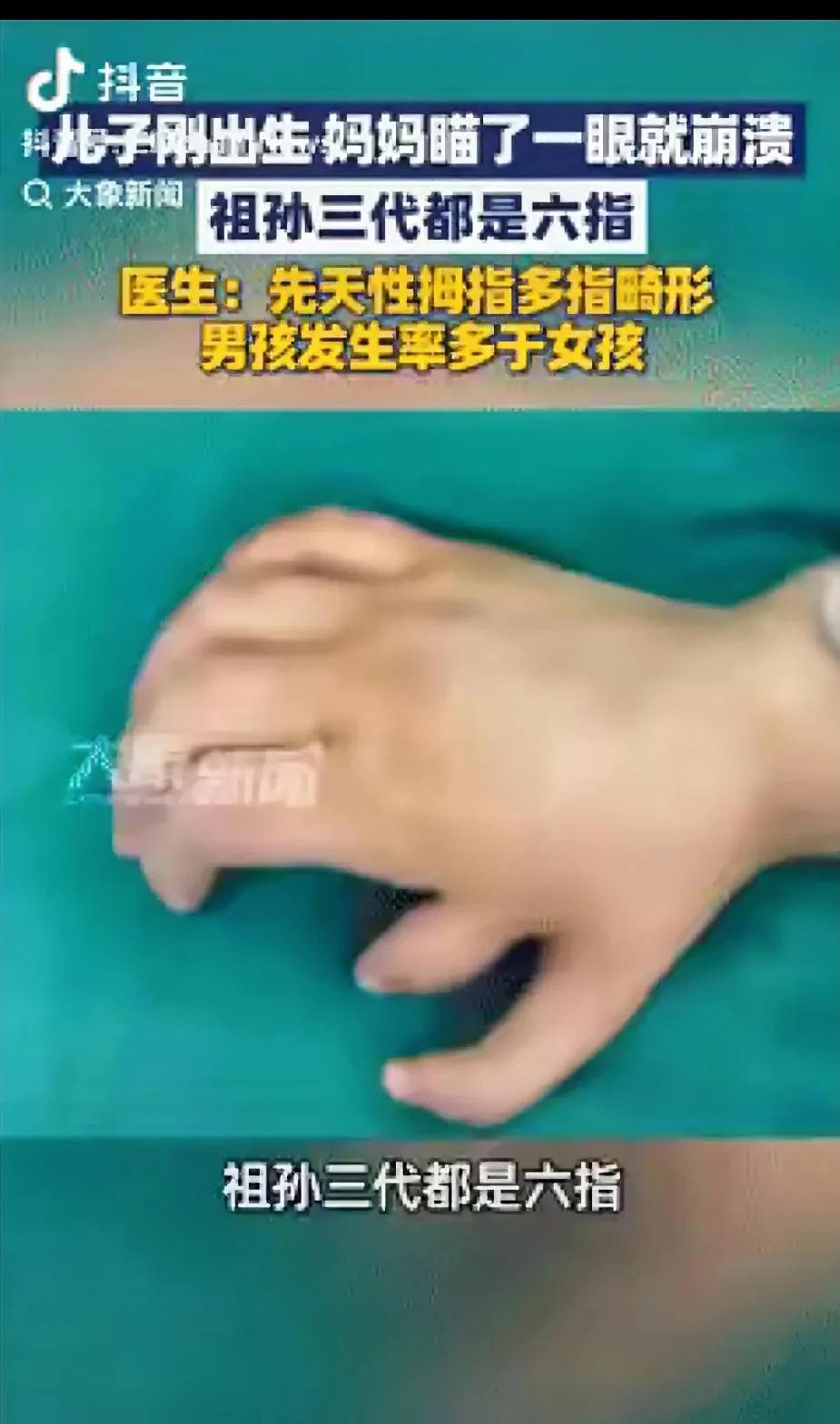 “真心疼！”浙江杭州，女子刚生了宝宝只看了一眼就崩溃了，原来女子的爸爸和她是六指
