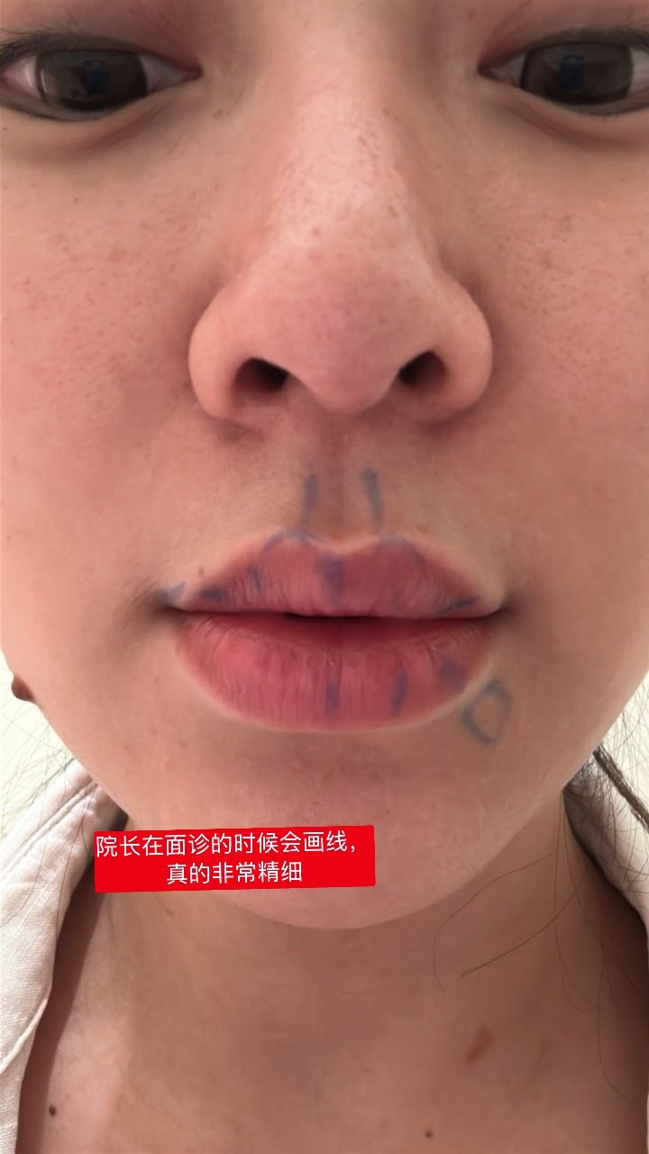丰唇/嘴巴👄功课来了首先不开任何团也不是广哈没耐心看的姐妹直接跳到第四段开始看