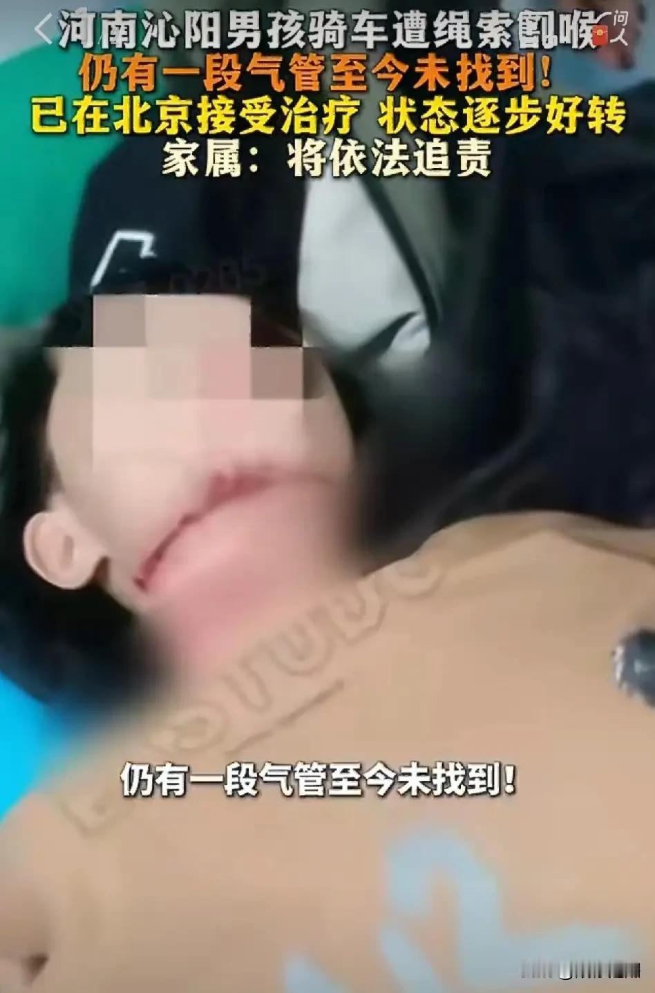 河南被绳子割喉的13岁男孩，活下来了。

据报道，4月14日，这个让网友们牵挂的