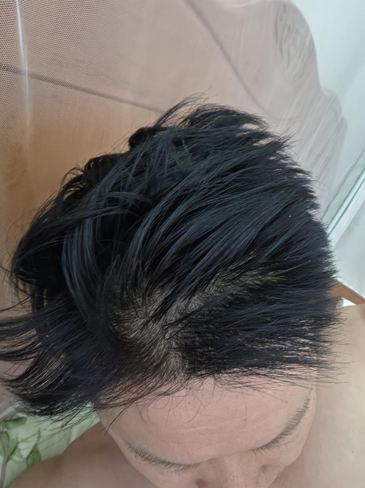 这是我的头发，黑不黑吧？硬不硬吧？不脱发不掉发！从2001年吃这些维生素到现在，