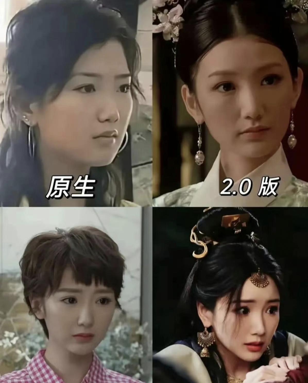 她从出道以来颜值确实变化了，变的越来越好看了，现在科技发达了，明星谁不做医美啊，
