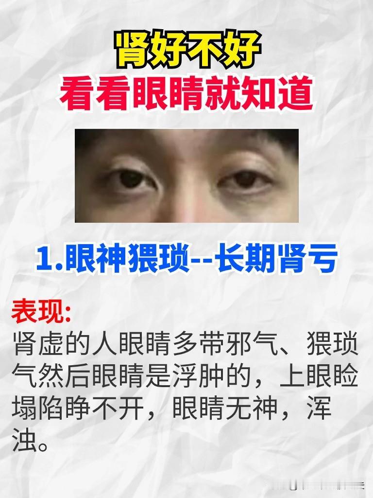 肾好不好，看看眼睛就知道
1.眼神猥琐--长期肾亏
表现:肾虚的人眼睛多带邪气、