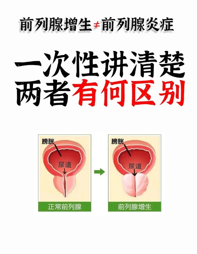 前列腺增生≠前列腺炎！一次性讲清楚两者有何区别！