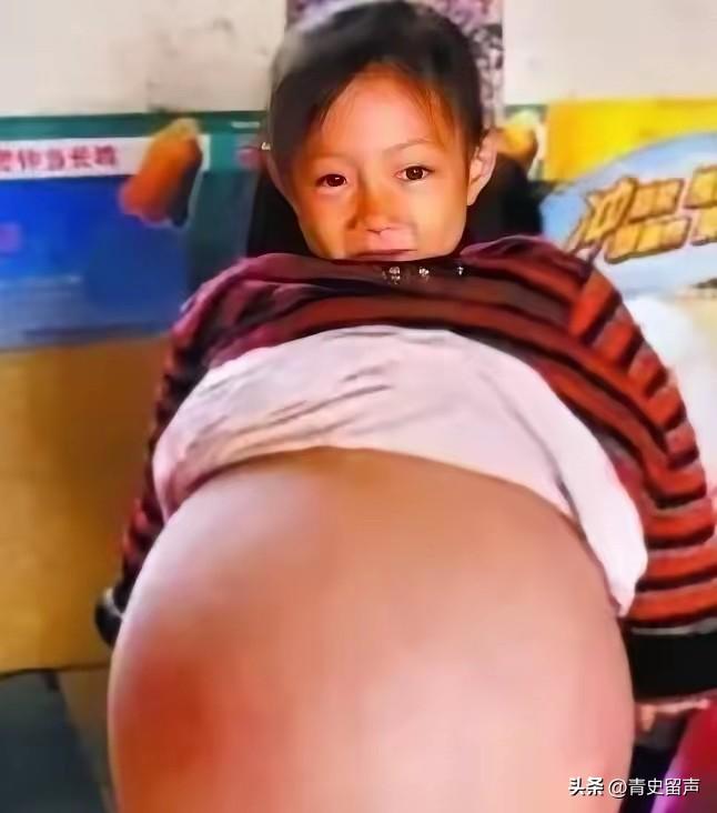 山西一4岁小女孩，肚子异常鼓胀，大得像足月孕妇。多家医生轮番诊断，残酷预言她活不