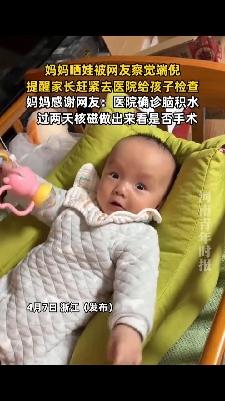 妈妈晒娃被网友察觉端倪，提醒家长赶紧去医院给孩子检查。
河南青年时报。
妈妈感谢