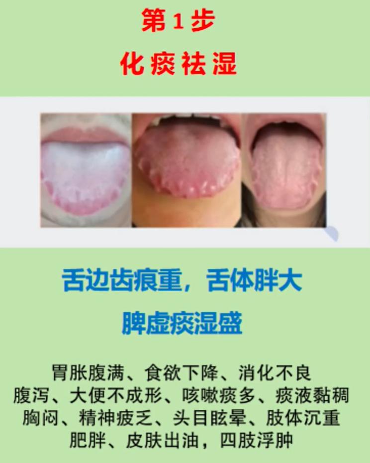 中医舌诊三步法：看懂脾虚痰湿、肝郁克脾、心肾不交舌象
