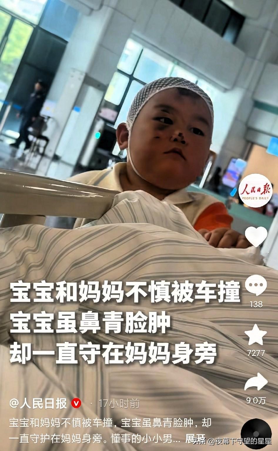 宝宝和妈妈不慎被车撞，宝宝虽鼻青脸肿，却一直守护在妈妈身旁。
 
这是浙江衢州的
