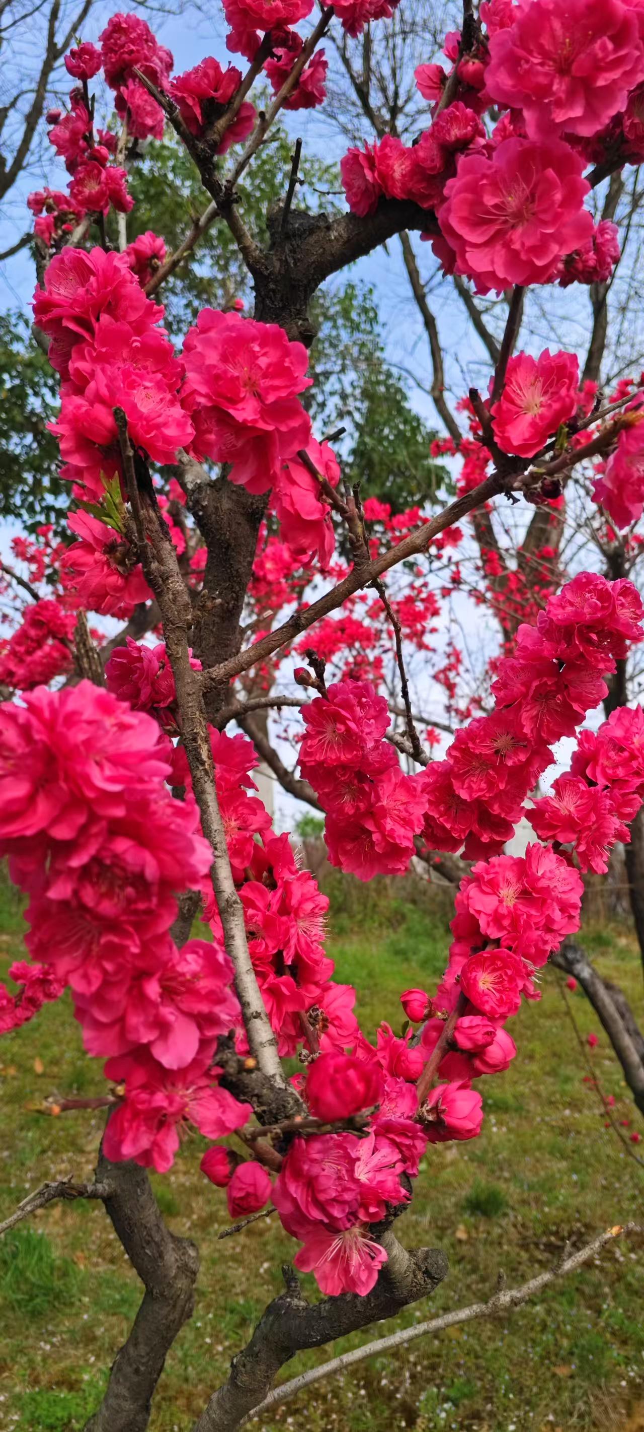 育孩子今夕对比——其中的差异真不小。
 
1. 过去已婚育龄妇女，两个月一次孕检
