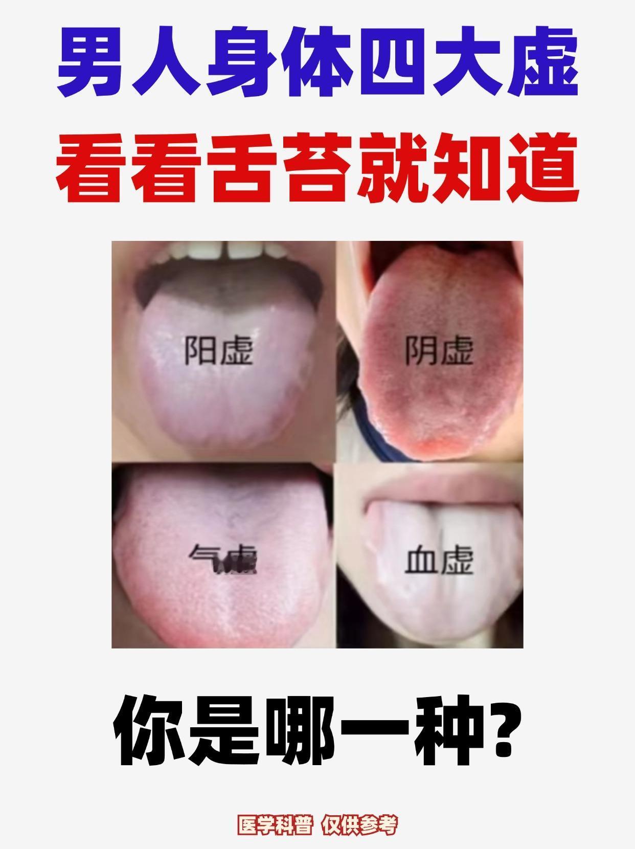 男人身体四大虚，看看舌苔就知道！#涨知识##健康##科普##中医##健康养生##