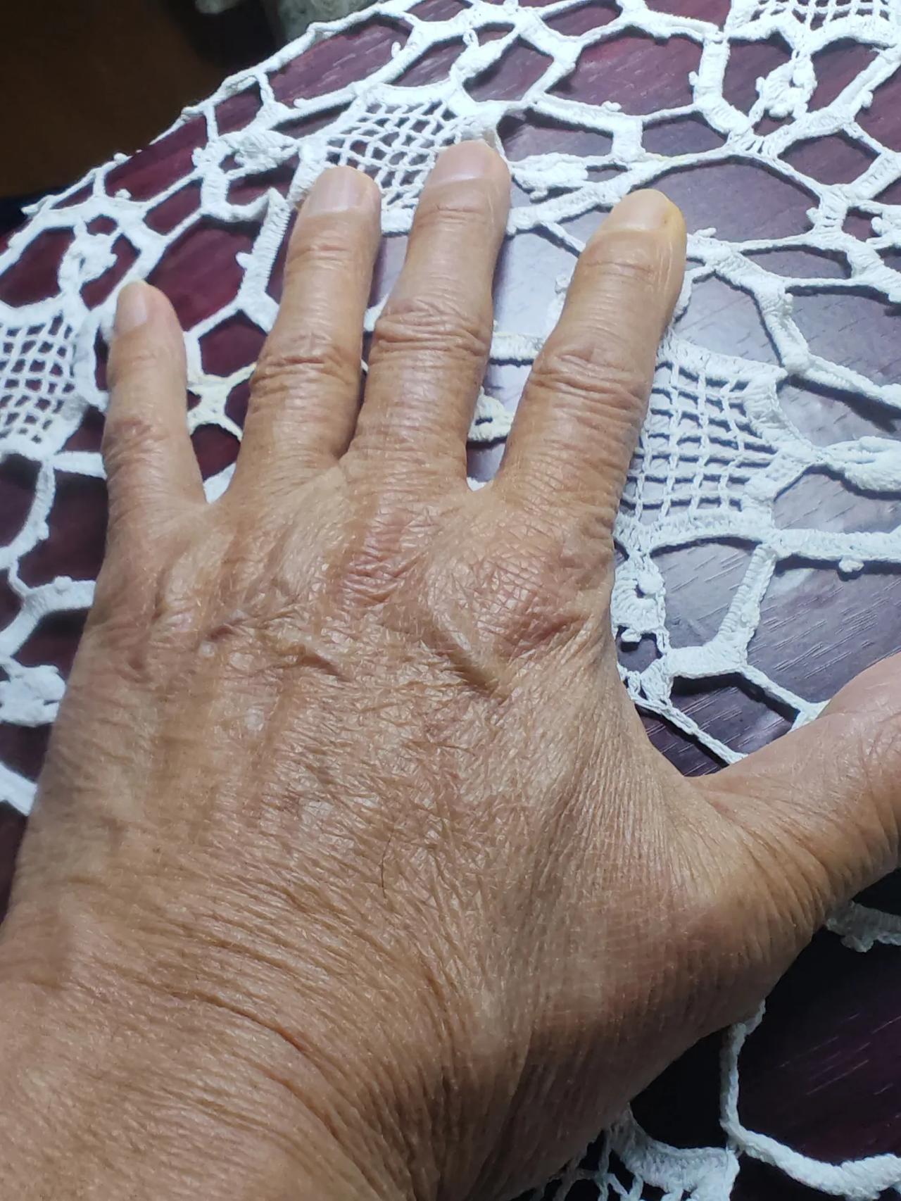 我刚才看自己的手，还没长老年斑。