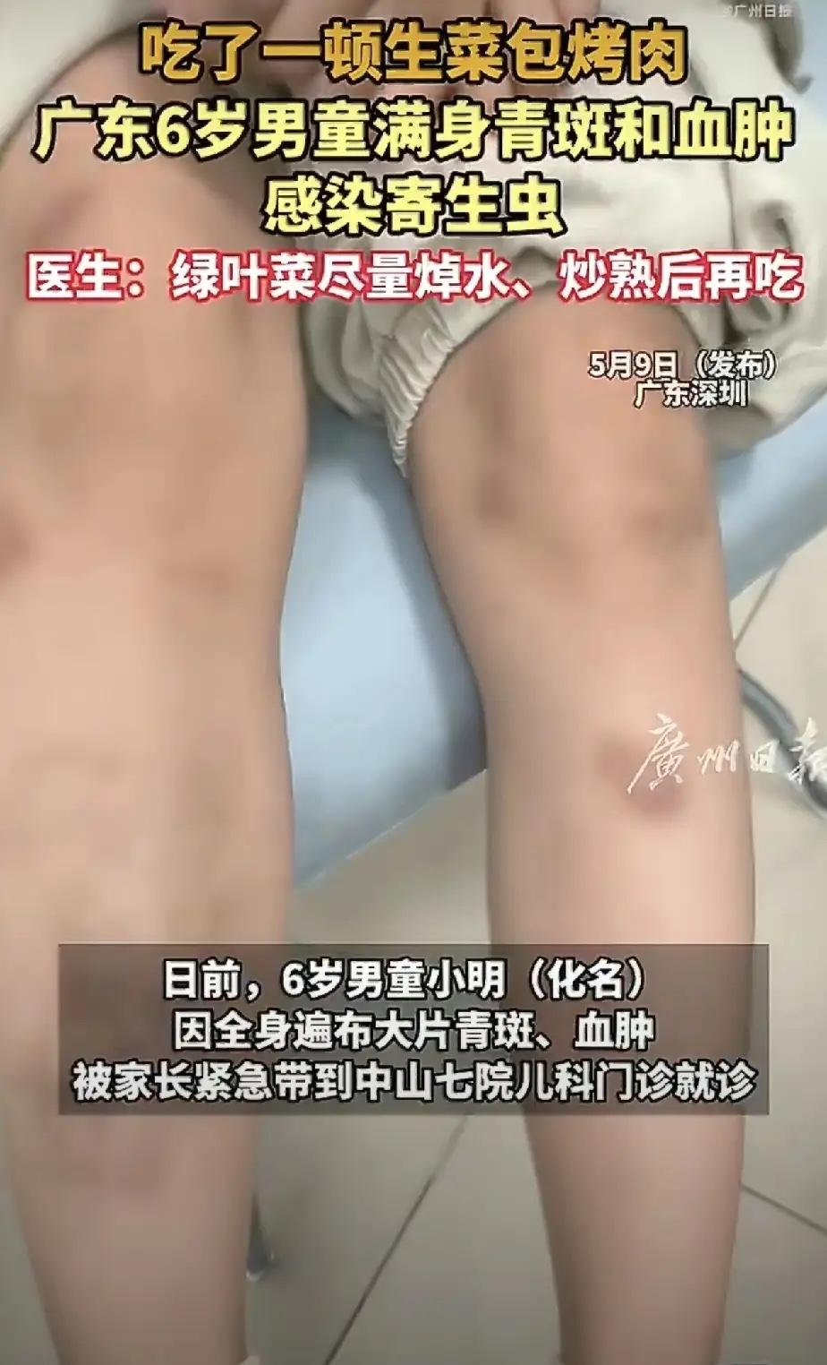 爱吃生菜、常吃凉拌菜的人，真别再盲目大意了。

现在不光生菜要谨慎，就连黄瓜西红