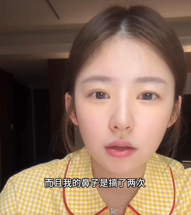 黄一鸣自曝整容失败 “捞姐”成功上岸的黄一鸣直播自曝整容整鼻子失败了，嘴巴还有后