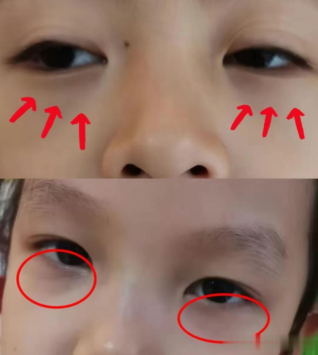 孩子长不高的原因找到了！内热不清除，孩子难长高

孩子不长高其实早有预兆，家长们