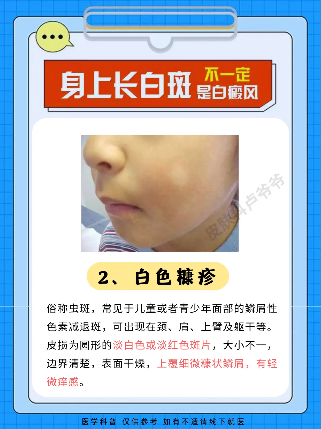 白斑不一定是白癜风