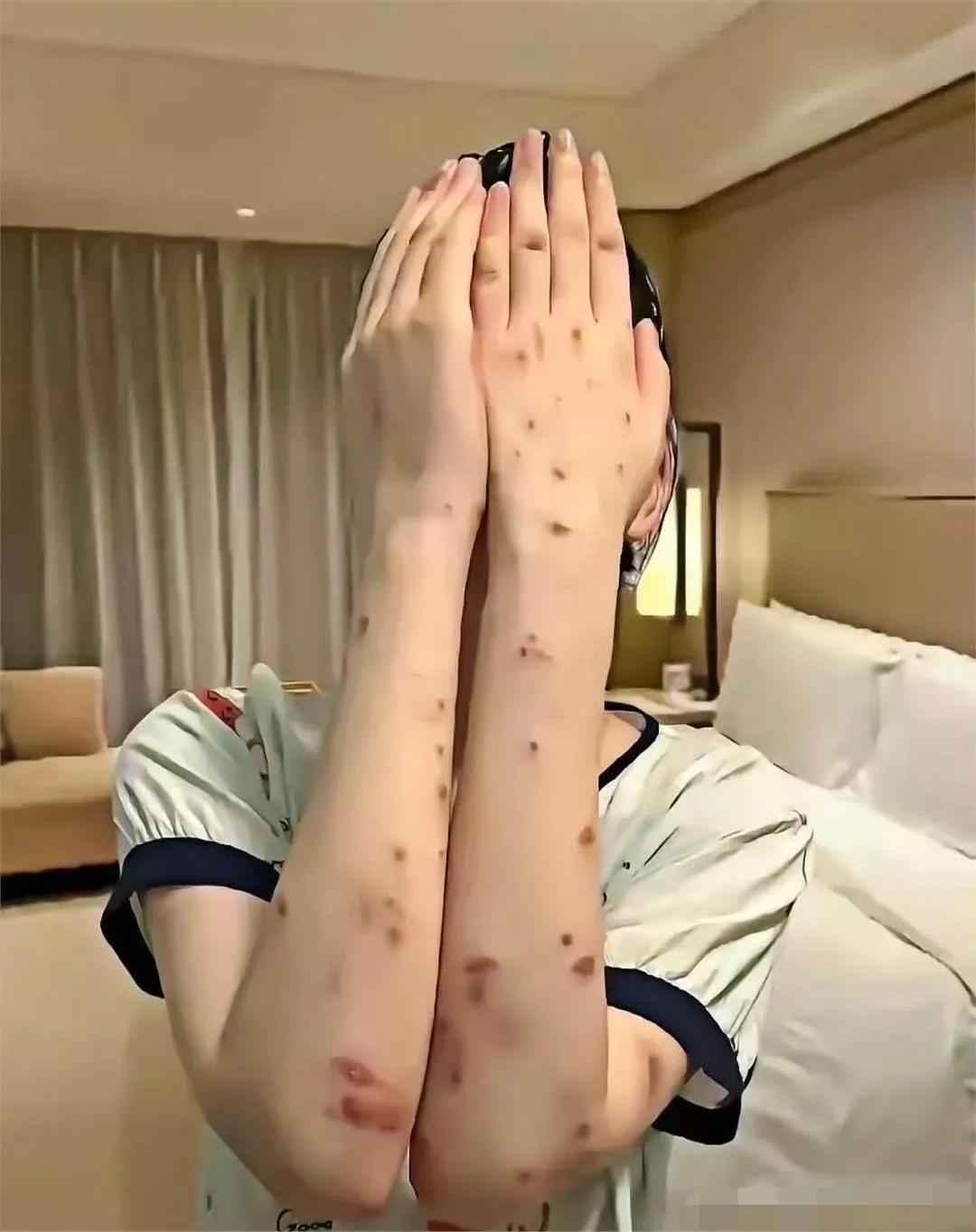 请问各位网友，这是怎么回事？我应该挂哪个科？