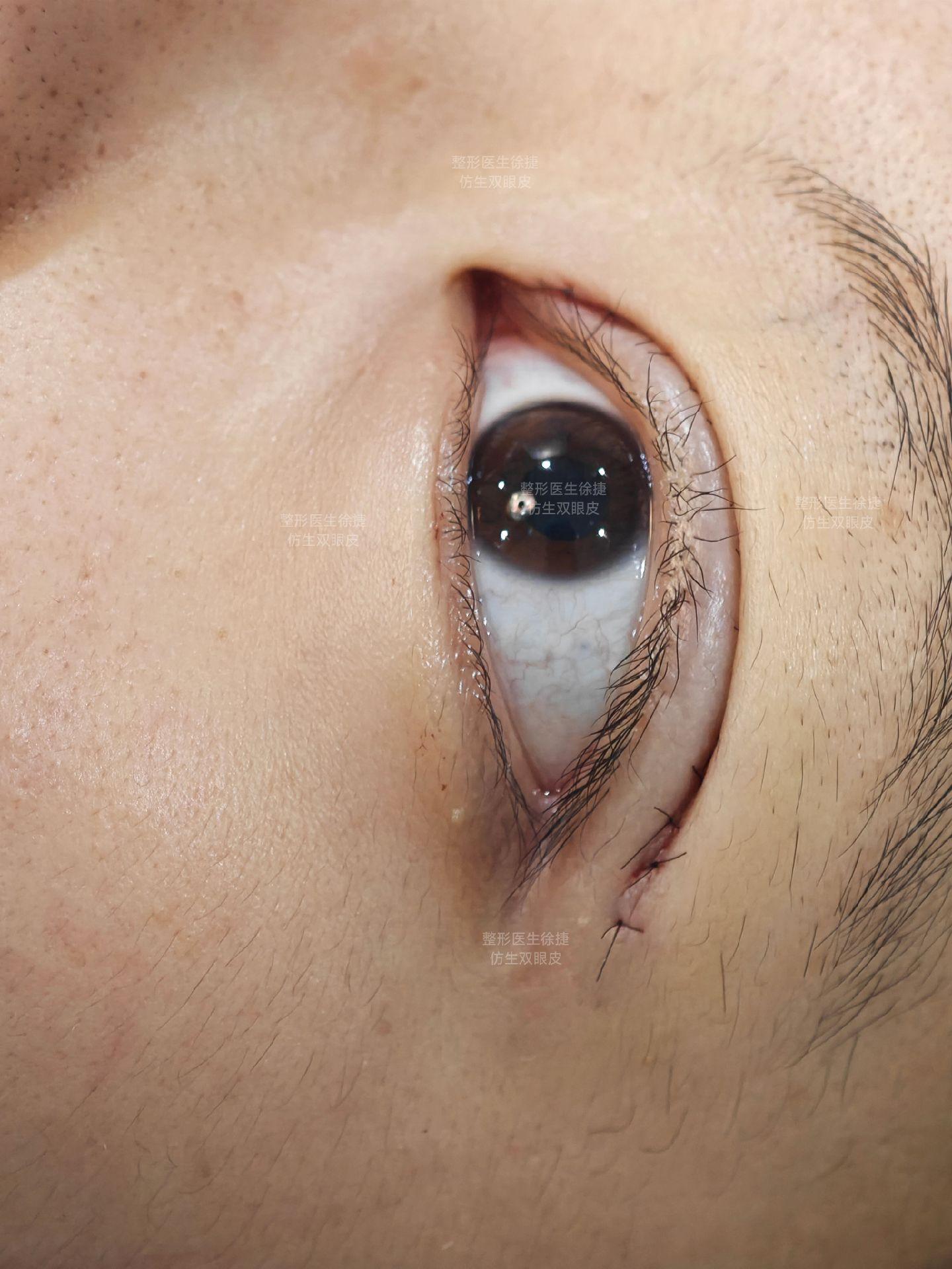 姐姐蒜皮✅。今天是双胞胎，上午姐姐蒜皮✅，下午是妹妹