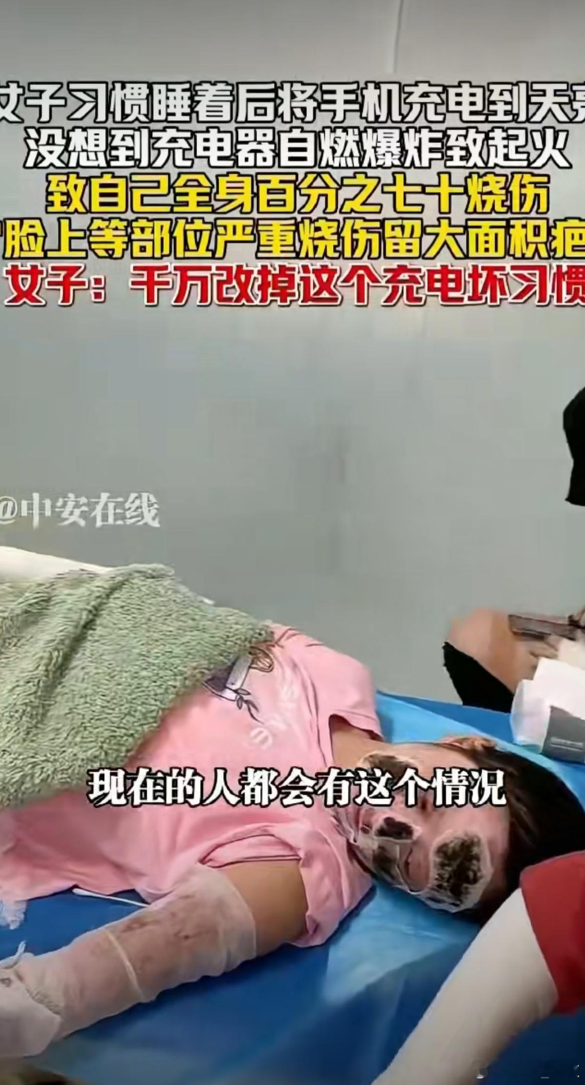 女子彻夜充电致全身70%烧伤 手机电量很低的时候也是这样充电，看来要更改一下这个