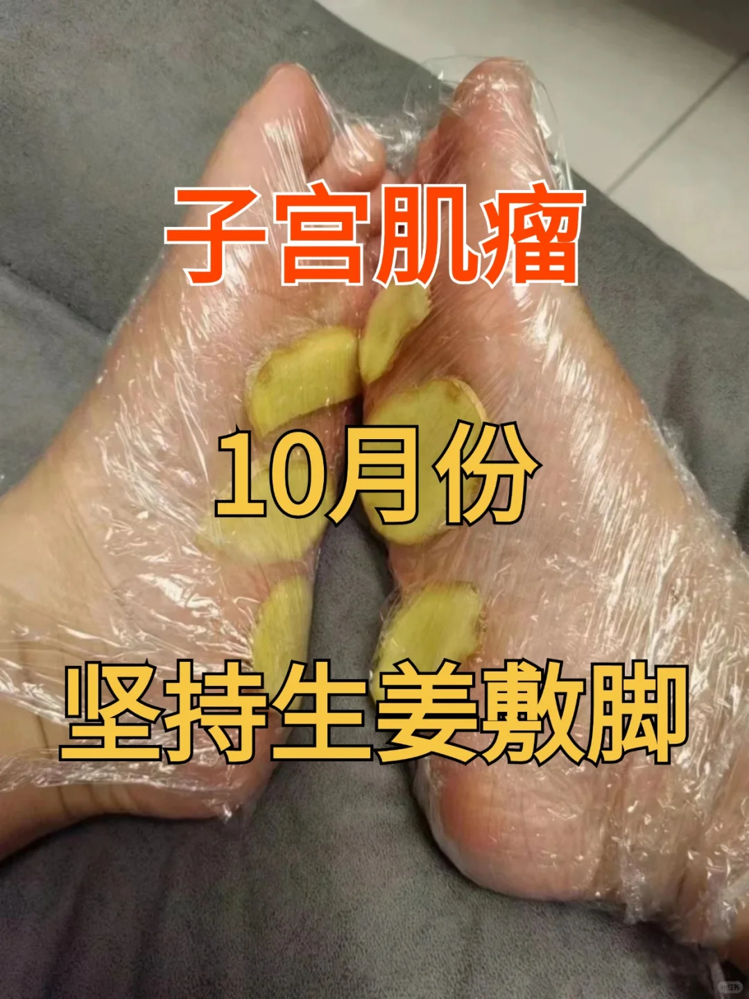 临床这么多年，我发现其实，很多患有子宫肌瘤的朋友，大都和作息、生活不良...
