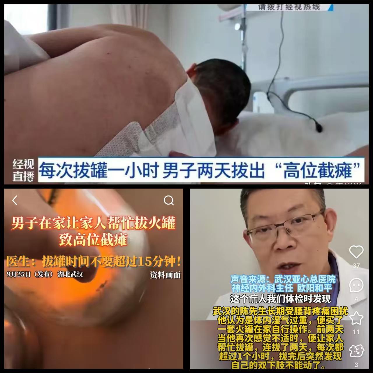 “担心的事情还是发生了！”

湖北武汉，一男子长期腰背疼痛，

可他没去医院检查