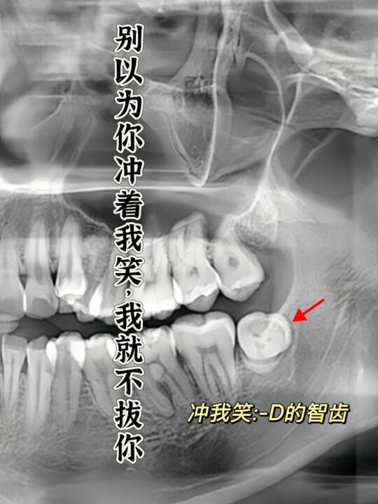 听说爱笑的智齿运气都不会太差