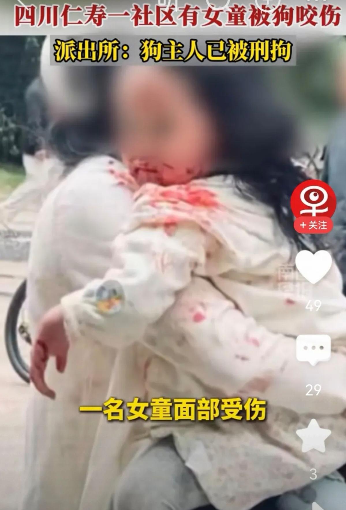 “看到四川仁寿那个被狗咬伤的小女孩，面部遭受严重撕咬需紧急送医，心里真不是滋味。