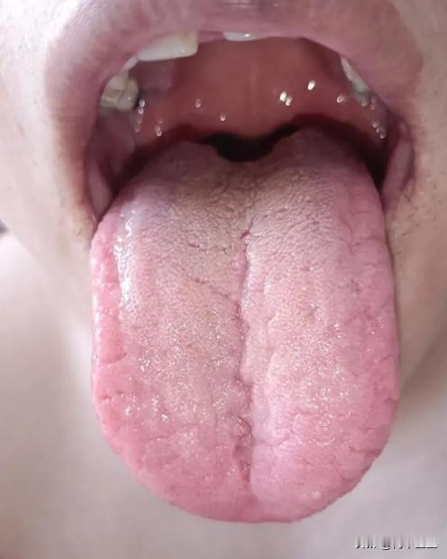我们来看这位朋友的舌头，才40岁，给我的第一感受就是虚，为什么这么说呢？

我们