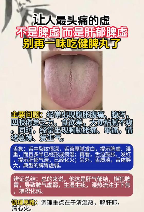 舌中深裂纹舌苔厚腻，肝郁脾虚湿热交织调理思路